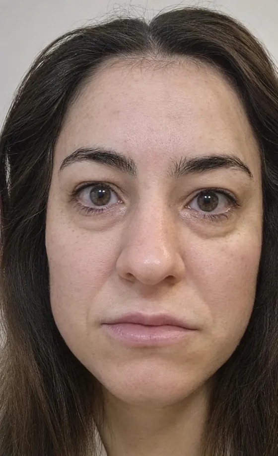 Rosto de Ana Maria Cepeda antes, sem maquiagem e de cabelo solto